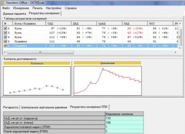 sfigmografya